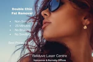 ReMuve Laser Centre (Non-Surgical Fat Removal), Vancouver and Burnaby - cosmetic in Vancouver, BC - image 2
