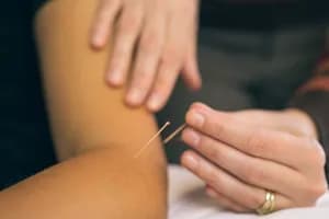 Allied Physio - 152 St - Acupuncture - acupuncture in Surrey, BC - image 3