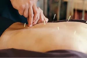 TCM Acupuncture - Barrie (Osteopathy) - osteopathy in Barrie, ON - image 3