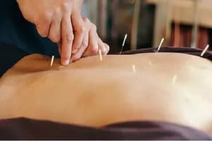 TCM Acupuncture - Orillia - acupuncture in Barrie, ON - image 3