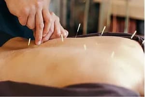TCM Acupuncture - Orillia (Osteopathy) - osteopathy in Orillia, ON - image 3