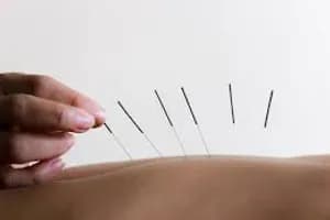 Healing Sense Clinic - Acupuncture - acupuncture in Burnaby, BC - image 4