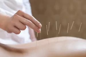 Avalon Laser Health Physiotherapy and Wellness - Acupuncture - acupuncture in St. John's, NL - image 1