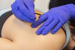 Market Mall Physiotherapy - Acupuncture - acupuncture in Calgary, AB - image 3