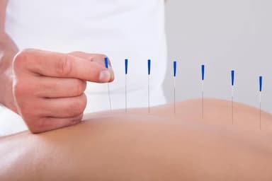 Clinique de Médecine Complémentaire - acupuncture in Mirabel