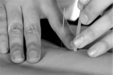 Body Dynamics - Acupuncture - acupuncture in York
