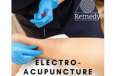 Remedy Wellness Centre - Acupuncture - acupuncture in Victoria