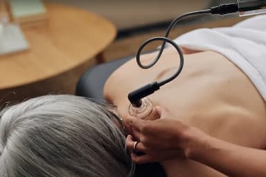 Chipperfield Mobile Physiotherapy - Acupuncture - acupuncture in Vancouver